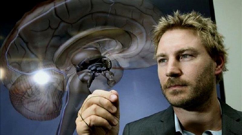 El aparato implantado mediante un catéter captará las señales cerebrales para que los pacientes puedan desplazarse tras la emisión de órdenes de sus mentes.