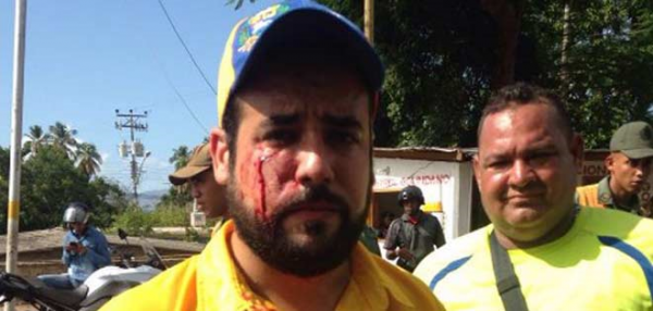 el Diputado a la Asamblea Regional del estado Sucre, Paul Elguezabal, fue agredido 