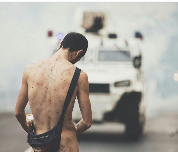 El joven pidió que no lancen más bombas a los manifestantes/ Foto: Donaldo Barros