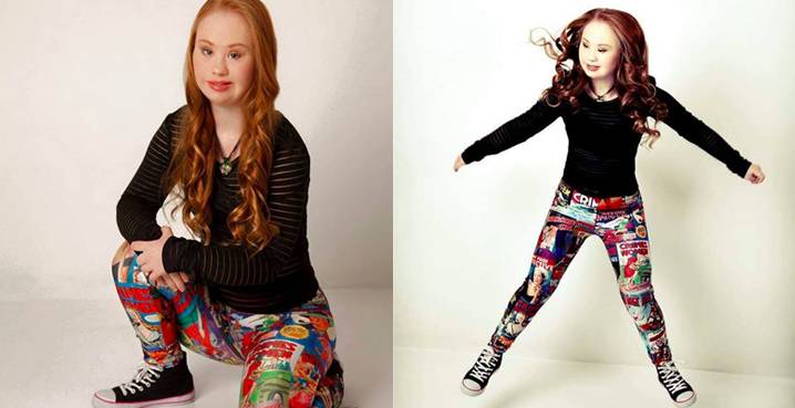 Madeline Stuart es una joven que rompió estereotipos y ahora es modelo a pesar de tener Síndrome de Down