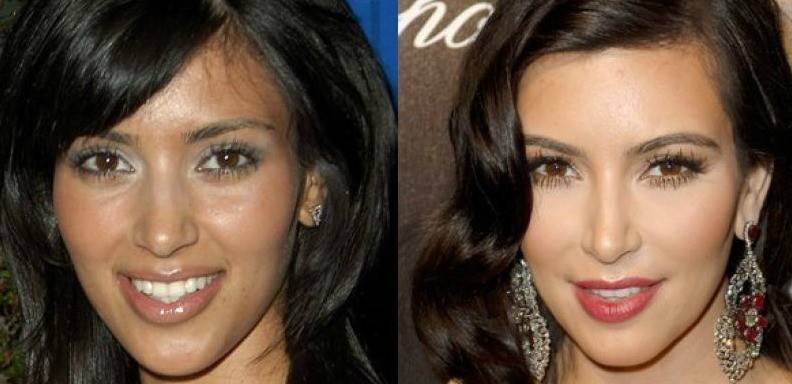 Kim Kardashian antes y después/ Foto: cortesía