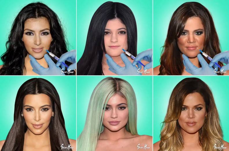 El antes y el después de las cirugías de las hermanas Kardashian/ Foto:Saint Hoax 