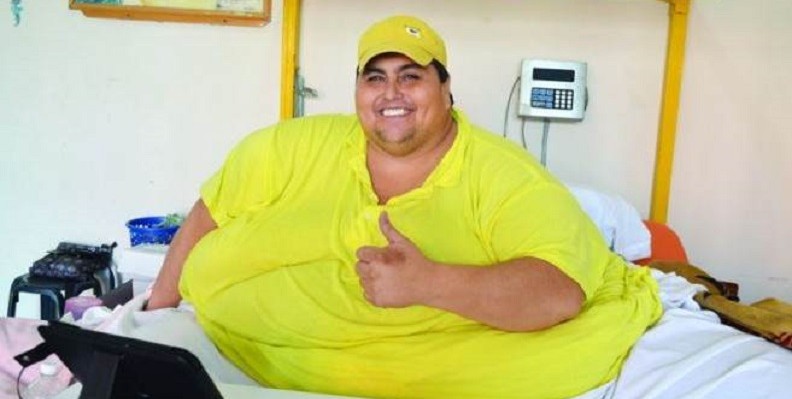 Andrés, que llegó a pesar 444 kilos, fue sometido a una derivación biliopancreática con cruce duodenal