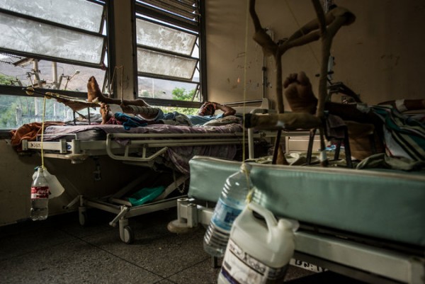 Los doctores del Hospital Luis Razetti en Venezuela improvisan, con jarras y envases de plástico, para estabilizar a los pacientes con fracturas. Credit Meridith Kohut para The New York Times.