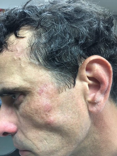 El gobernador de Miranda, Henrique Capriles, junto con su equipo de trabajo fue agredido por un grupo de funcionarios de la Guardia Nacional en Las Mercedes Foto: Prensa Comando Simón Bolívar