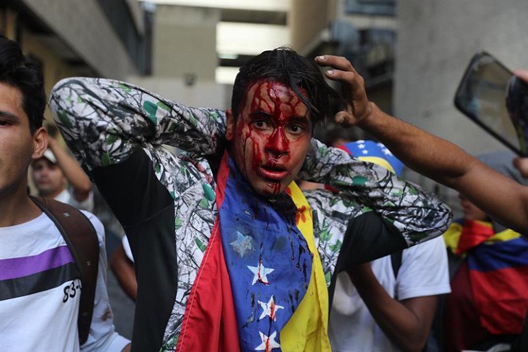 AI pide investigar crímenes de lesa humanidad en Venezuela